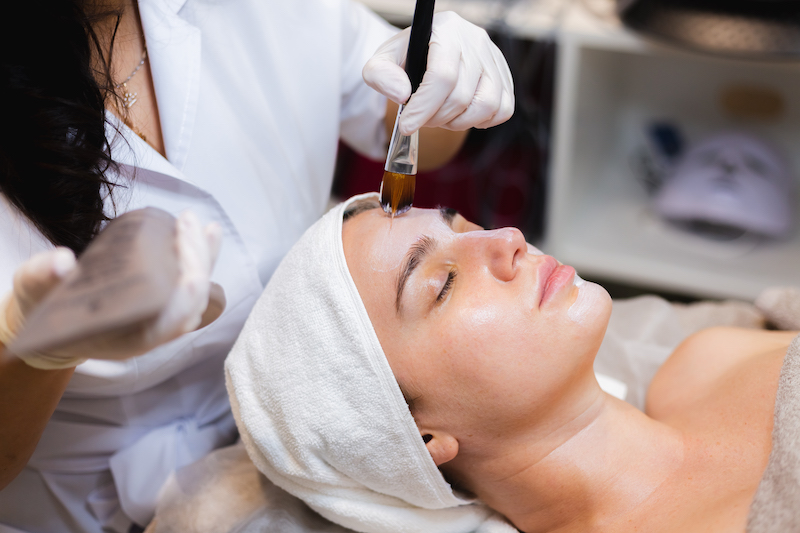 A woman is lying down and receiving a chemical peel treatment that is paired with Morpheus8 in Westlake, OH.