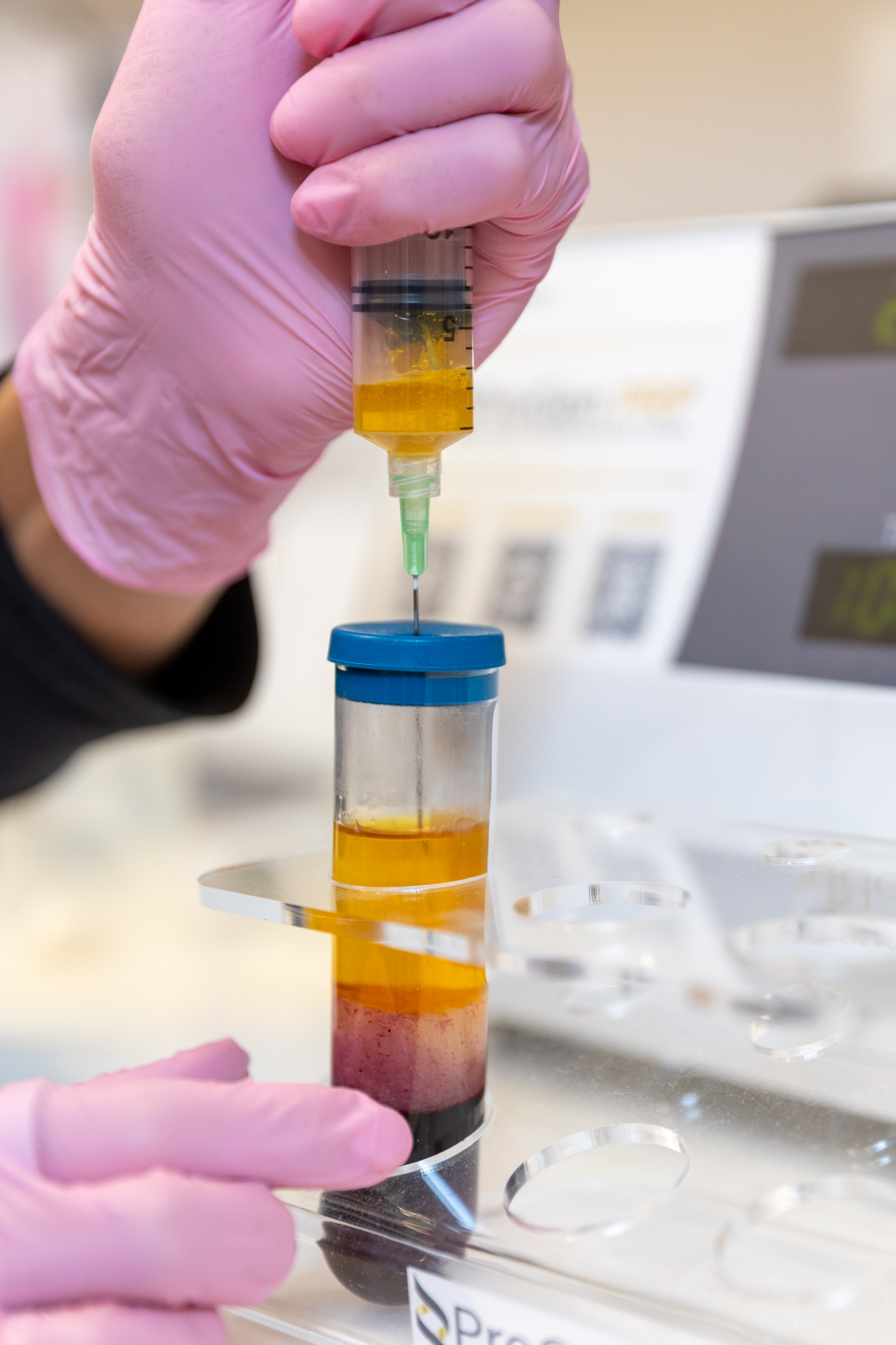 Close up of PRP being prepared by gloved hands.