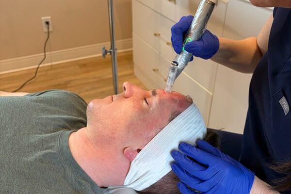 A provider uses the EvoPen microneedling stylus to administer a patient's skin-tightening treatment in Westlake.